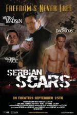 Watch Serbian Scars 2KMovies